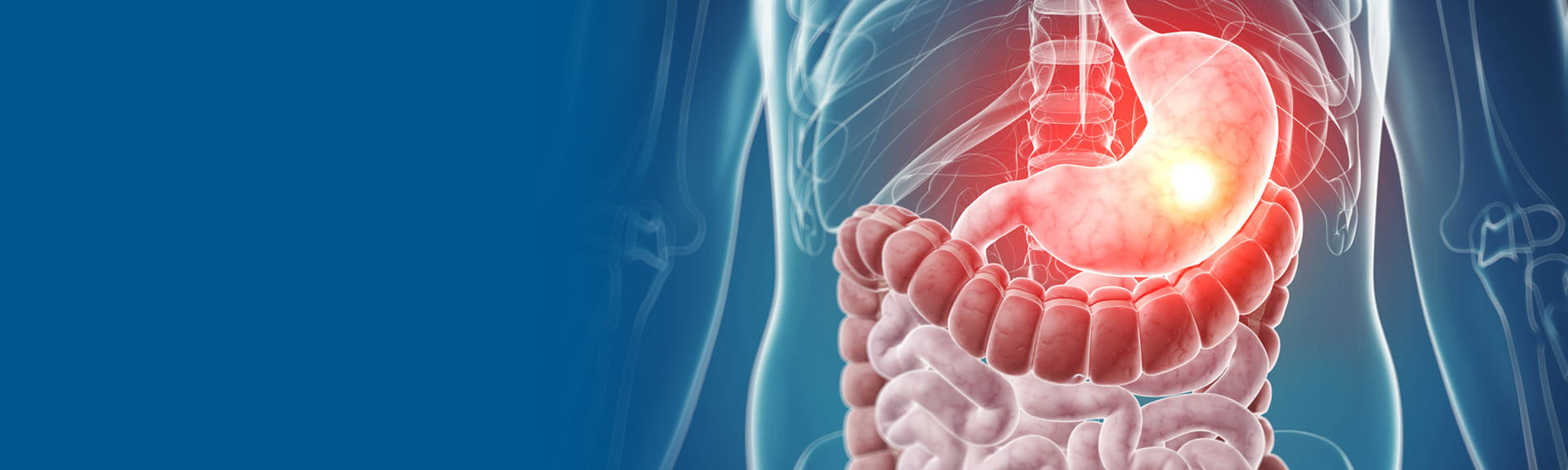 Cirurgia videolaparoscópica do aparelho digestivo